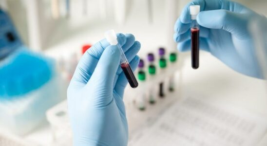 Τεστ αίματος θα δείχνει στο μέλλον αν ένα εμβόλιο "δουλεύει"