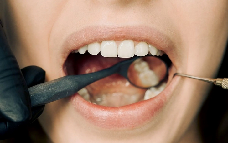 Πώς να ελέγξετε το στόμα σας για καρκίνο – Τα 6 σημάδια που πρέπει να προσέξετε